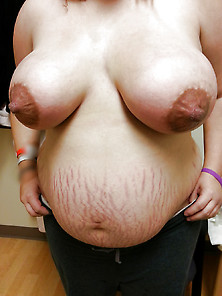 Big Nippled Women With Stretch Marks Or Scars