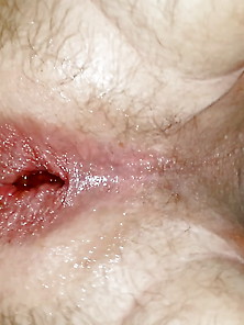 Anal Gape From Prostate Milking