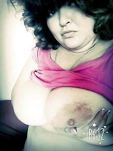 Fatty With Huge Breasts