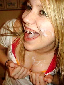 Braces Are Made For Cum