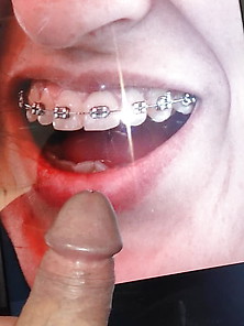 Cum Tribute To Mouth With Braces
