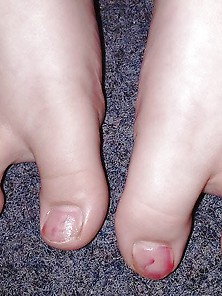 Nanas Feet 7